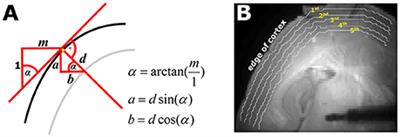 Propofol and Sevoflurane Differentially Modulate Cortical Depolarization following Electric Stimulation of the Ventrobasal Thalamus